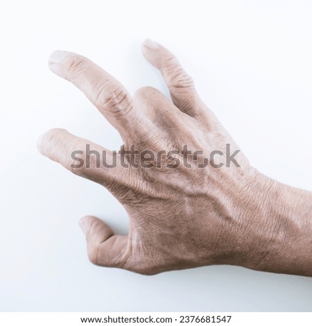 Finger of seniors who have problems trigger fingers on a white background.