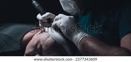 Capturing photos from the moment of a hair transplant. the doctor opens the channel for hair transplantation Royalty-Free Stock Photo #2377343609
