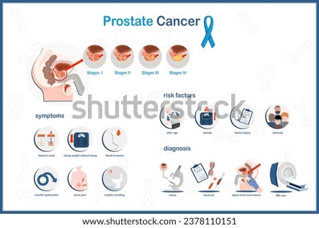 Flat vector concept Medical infographic illustration of prostate cancer.states of prostate cancer,symptoms,risk factors and diagnosis of prostate cancers.isolated on white background. Royalty-Free Stock Photo #2378110151