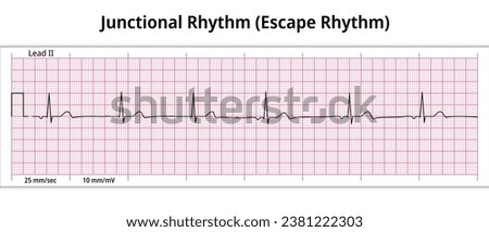 ECG Junctional Rhythm - Escape Rhythm - 8 Second ECG Paper - Electrocardiogram Vector Medical Illustration Royalty-Free Stock Photo #2381222303