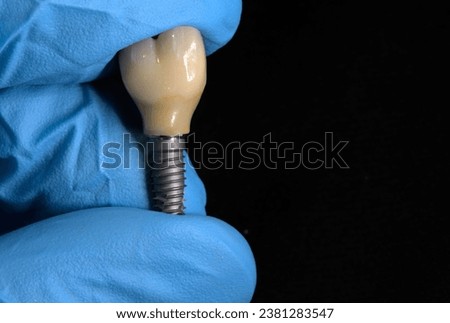 Dental Implant , crown and titanium implant. Royalty-Free Stock Photo #2381283547