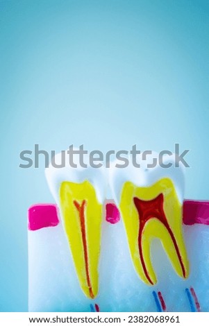 Dental tooth model showing teeth decay, gums and root canal.