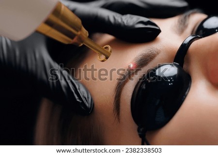 Laser removal of tattoo permanent makeup eyebrow of young woman in salon. Royalty-Free Stock Photo #2382338503