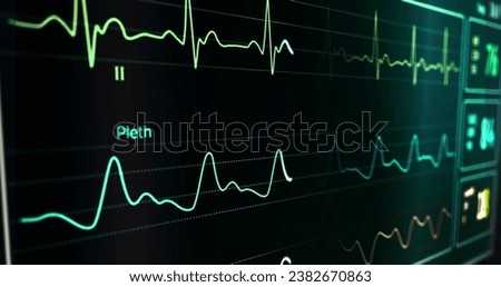 ECG cardiac heart rate monitor in hospital loop able, Cinematic Close-Up of Heart Rate Monitor in Hospital Electronic Health Monitor Machine Checks Vital Signs of Ill Patient. Electronic Machine.