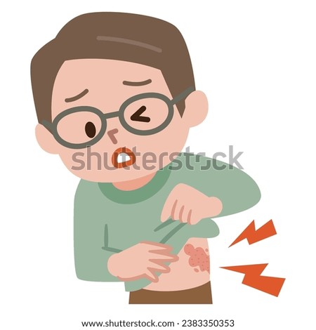 Vector illustration of the symptoms of shingles Royalty-Free Stock Photo #2383350353