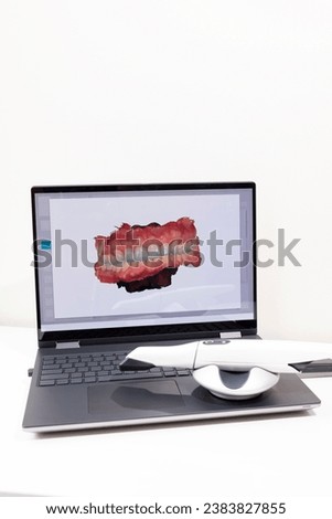 3D Picture of Scanned Teeth on Monitor of Computer, Notebook. White 3d Intraoral Dental Tooth Scanner Lying on Table. Dental Equipment, Device For Scanning Teeth. Copy Space. Vertical Plane