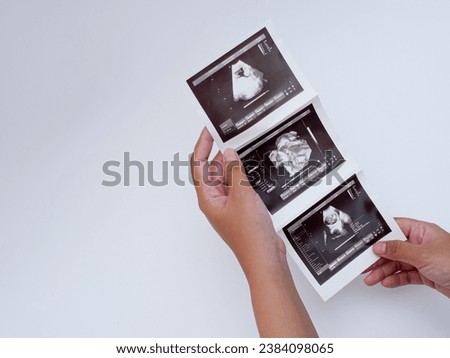 hand holding image of pregnancy ultrasound results isolated on white