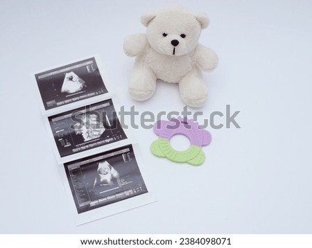image of pregnancy ultrasound results and teddy bear showing a girl