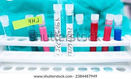 man hands with medical rubber gloves and mask for protection from hantavirus with text Rat in cage mousetrap on white background, Mouse finding a way out of being confined, Trapping and removal of rod Royalty-Free Stock Photo #2384487949
