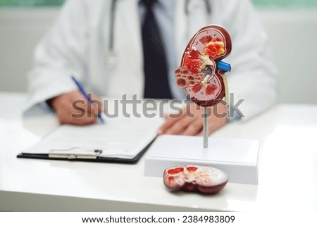 Chronic kidney disease, doctor with model for treatment urinary system, urology, Estimated glomerular filtration rate eGFR. Royalty-Free Stock Photo #2384983809