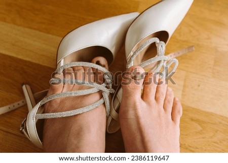 feet with swelling and bruising on toenails due to uncomfortable shoes, high heels, after work or walk, against parquet floor. view from above. Feet swell in tight shoes. bruise on thumbnail.  Royalty-Free Stock Photo #2386119647