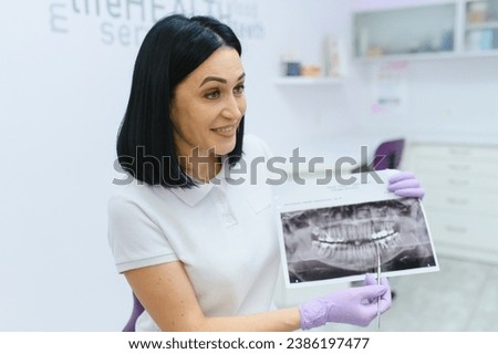 Dentist show by her finger on the milk tooth on the x-ray teeth image close up
