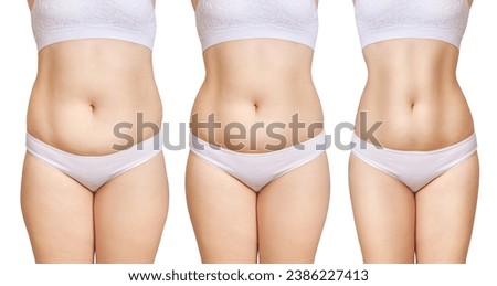 Woman's body before and after weight loss. Result of diet, liposuction, training concept. Copy space. Royalty-Free Stock Photo #2386227413