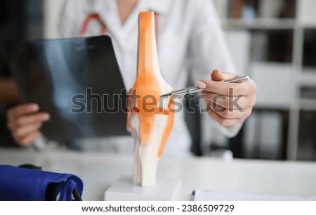 Doctor traumatologist examines x-ray and legs and the model of knee joint. Injuries and sprains concept Royalty-Free Stock Photo #2386509729