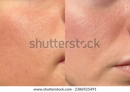 Skin treatment. Before after. Beauty close up portrait of young woman with a healthy glowing skin is applying a skincare product. Royalty-Free Stock Photo #2386925491