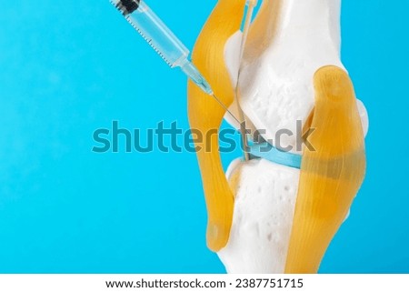 Intra-articular injection of anti-inflammatory medication into a mock-up knee joint on a blue background. The concept of drug blockade to relieve pain and inflammation. Copy space for text Royalty-Free Stock Photo #2387751715