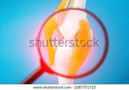 Medical mockup of a knee joint on a blue background under a magnifying glass. Concept of pain and inflammation in the knee joint, redness. Gonarthrosis and arthritis. Knee cartilage injury  Royalty-Free Stock Photo #2387751725