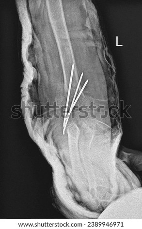 Detailed X-ray illustrating successful fixation of an elbow joint fracture. The image showcases the precise alignment of the fractured elbow bones. Royalty-Free Stock Photo #2389946971