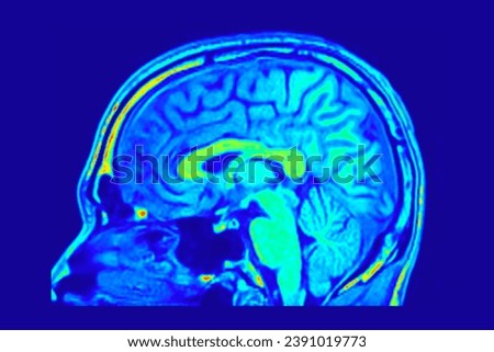 Sagital colorful Slice of Human Brain MRI.  Image shows the human brain with this mesmerizing sagital slice captured by a 1.5 Tesla MRI machine. Explore the fascinating world of neuroscience