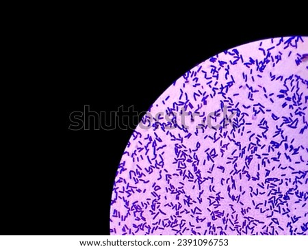 Bacterial colonies gram stained microscopic show gram positive Lactobacillus spp. probiotic bacteria. Close up micrograph Royalty-Free Stock Photo #2391096753