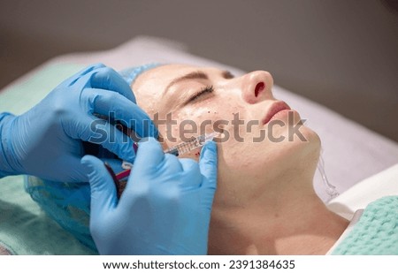 Injection facial rejuvenation. Biorevitalization and mesotherapy. A cosmetologist injects cosmetic preparations into the facial skin to moisturize, firm and rejuvenate the skin. Royalty-Free Stock Photo #2391384635