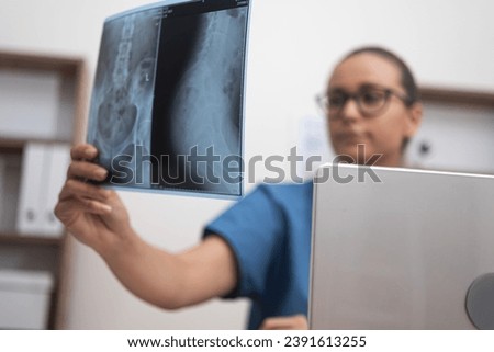 Medical Expertise: In the clinic, a female physician meticulously analyzes a patient's X-ray film scan while cross-referencing test results on her laptop. 