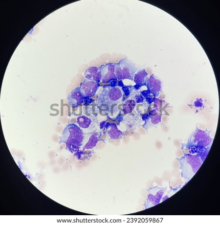 Abnormal cells in body fluid. Royalty-Free Stock Photo #2392059867