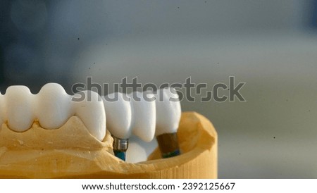 Dentin on a dental model ready to be fitted by dentist.