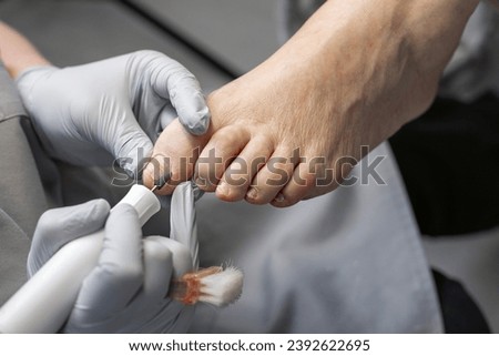 The process of filing off a thickened old nail from the fingers of an elderly woman. Procedure podologist.  Royalty-Free Stock Photo #2392622695