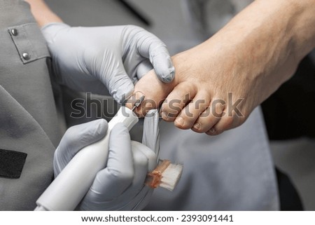 The process of filing off a thickened old nail from the fingers of an elderly woman. Procedure podologist.  Royalty-Free Stock Photo #2393091441