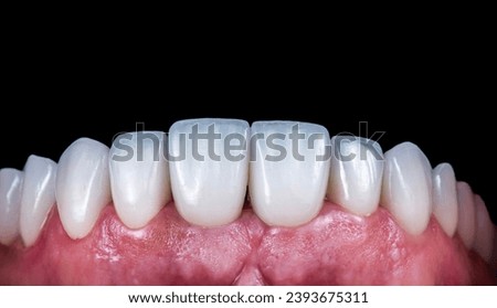 dental professional photography of dental work