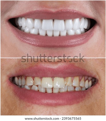 dental professional photography of dental work Royalty-Free Stock Photo #2393675565