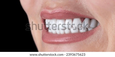 dental professional photography of dental work