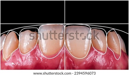 a digital new smile design Royalty-Free Stock Photo #2394596073