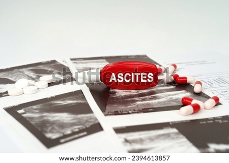 Medical concept. On the ultrasound pictures there are pills and a pen with the inscription - Ascites