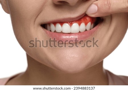 Woman showing inflamed gum on white background, closeup Royalty-Free Stock Photo #2394883137