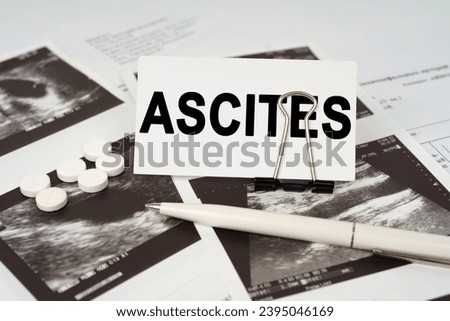 Medical concept. On the ultrasound pictures there is a pen and a business card with the inscription - Ascites