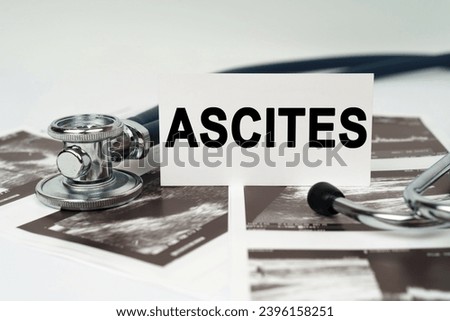 Medical concept. On the ultrasound pictures there is a stethoscope and a business card with the inscription - Ascites