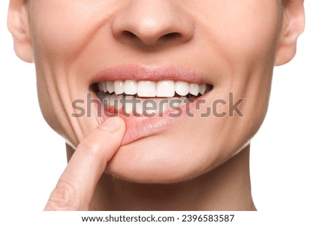 Woman showing inflamed gum on white background, closeup Royalty-Free Stock Photo #2396583587