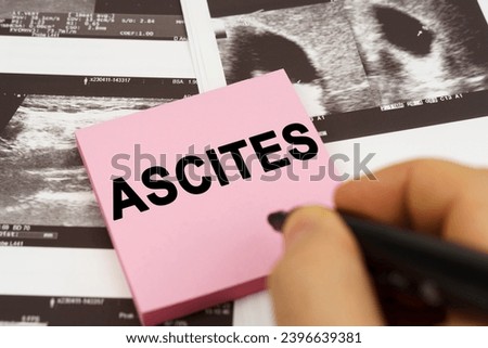 Medical concept. On the ultrasound pictures there are stickers that say - Ascites