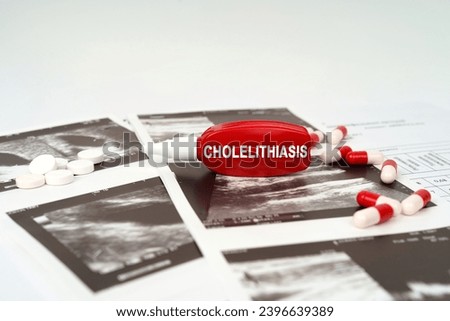 Medical concept. On the ultrasound pictures there are pills and a pen with the inscription - Cholelithiasis