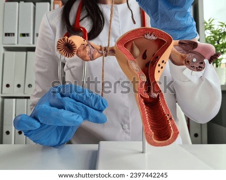 Doctor gynecologist ligates fallopian tubes on example of layout female reproductive system. Contraception concept for unwanted pregnancy Royalty-Free Stock Photo #2397442245