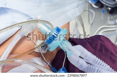 Medical equipment for anesthesia and ventilation in hospitals: endotracheal tubes, mask, oral airways, and machines aiding breathing during surgeries Royalty-Free Stock Photo #2398067897