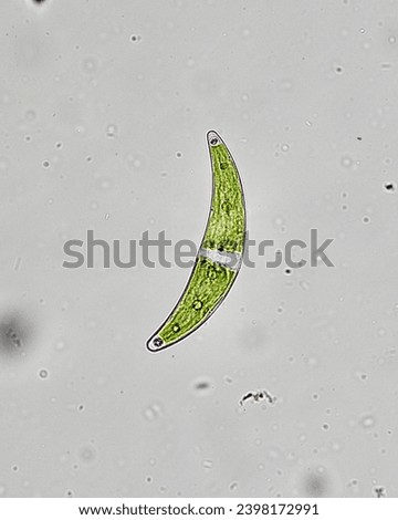 Closterium sp. a green algae belonging to Chlorophyta. Royalty-Free Stock Photo #2398172991