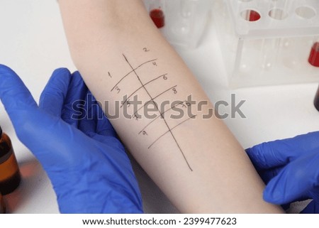 Doctor doing skin allergy test at light table, closeup Royalty-Free Stock Photo #2399477623