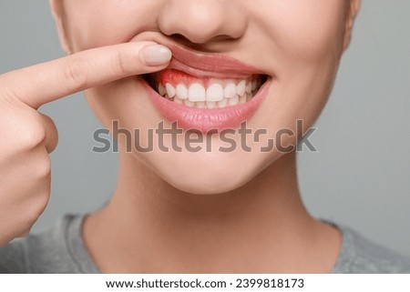 Woman showing inflamed gum on grey background, closeup Royalty-Free Stock Photo #2399818173