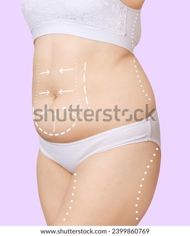 Female body with excess weight and dotted lines.
