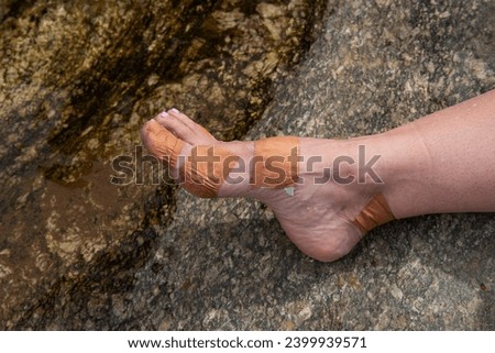 A woman hiker resting her tired foot full of blisters and plasters during a long hike Royalty-Free Stock Photo #2399939571