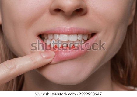 Woman showing inflamed gum, closeup. Oral cavity health Royalty-Free Stock Photo #2399953947