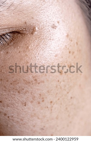 Woman's problematic skin pore and dark spots on the face Royalty-Free Stock Photo #2400122959